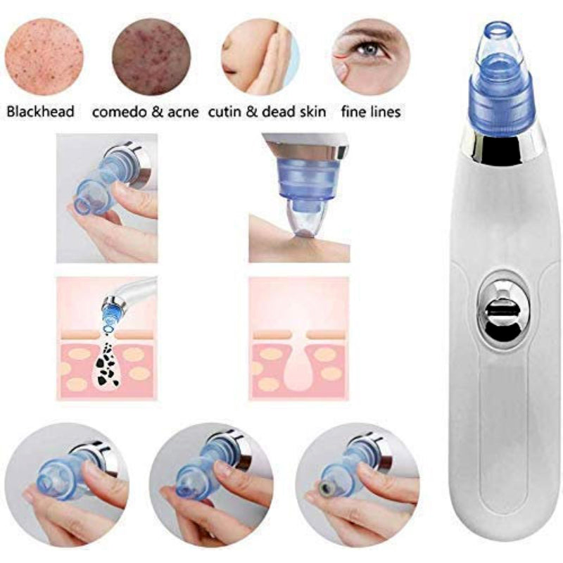 Derma Suction Blackhead Remover